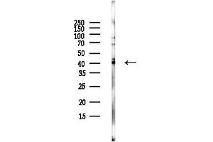 Western blot analysis of lysates from EC304 cells(LPS, 4h treatment), using P2RY9 Antibody at 1/1000 dilution.