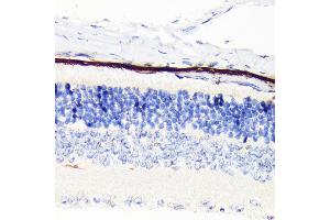 Immunohistochemistry of paraffin-embedded mouse retina using RPE65 Rabbit mAb (ABIN7269933) at dilution of 1:100 (40x lens). (RPE65 抗体)