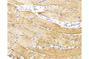 Immunohistochemistry analysis of parafffin-embedded rat skeletal muscle using Desmin Monoclonal Antibody at dilution of 1:300. (Desmin 抗体)
