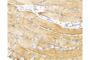 Immunohistochemistry analysis of parafffin-embedded rat skeletal muscle using Desmin Monoclonal Antibody at dilution of 1:300. (Desmin 抗体)