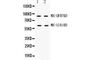 Western blot analysis of ADAM28 using anti-ADAM28 antibody . (ADAM28 抗体  (N-Term))