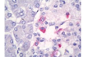 Anti-Somatostatin antibody IHC of human pancreas. (Somatostatin 抗体)