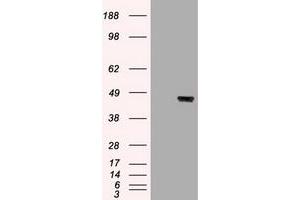 Image no. 1 for anti-Keratin 19 (KRT19) (AA 240-390) antibody (ABIN1491257) (Cytokeratin 19 抗体  (AA 240-390))