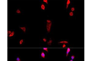 Immunofluorescence analysis of NIH/3T3 cells using EIF3J Polyclonal Antibody at dilution of 1:100.