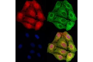 ABIN6261919 and ABIN6278467 staining Hela cells by IF/ICC. (GCLC 抗体  (N-Term))