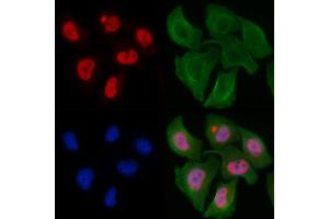 ABIN6256428 and ABIN6267317 staining Hela cells by IF/ICC. (Retinoblastoma Protein (Rb) 抗体  (pSer807))