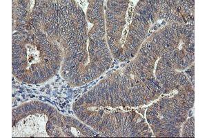 Image no. 1 for anti-Ras Homolog Gene Family, Member J (RHOJ) antibody (ABIN1501341) (RHOJ 抗体)