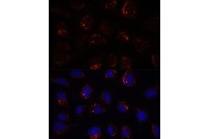 Immunofluorescence analysis of U-2 OS cells using BZW2 antibody (ABIN7265831) at dilution of 1:100. (BZW2 抗体  (AA 190-300))