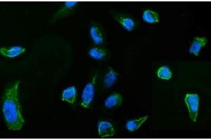 IF analysis of MSN using anti-MSN antibody (ABIN7600378). (Moesin 抗体  (AA 184-568))