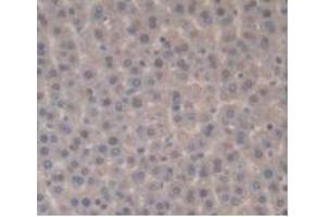 IHC-P analysis of Rat Liver Tissue, with DAB staining. (IL-33 抗体  (AA 110-261))