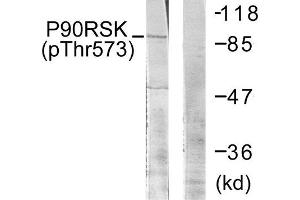 Western Blotting (WB) image for anti-Ribosomal Protein S6 Kinase, 90kDa, Polypeptide 3 (RPS6KA3) (pThr573) antibody (ABIN1847291) (RPS6KA3 抗体  (pThr573))