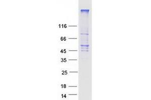 Western Blotting (WB) image for Solute Carrier Family 2 (Facilitated Glucose Transporter), Member 1 (SLC2A1) protein (Myc-DYKDDDDK Tag) (ABIN2721982)