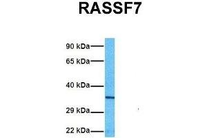 Host:  Rabbit  Target Name:  RASSF7  Sample Tissue:  Human A549  Antibody Dilution:  1. (RASSF7 抗体  (Middle Region))