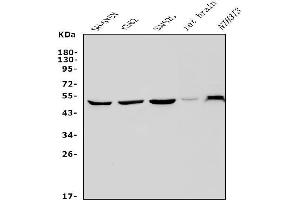 Western blot analysis of PAX3 using anti-PAX3 antibody (ABIN7601236).