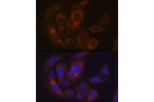 Immunofluorescence analysis of U-2 OS cells using Pumilio 1 Rabbit mAb (ABIN1682469, ABIN3015222, ABIN3015223 and ABIN7101323) at dilution of 1:100 (40x lens).