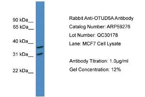WB Suggested Anti-OTUD6A  Antibody Titration: 0. (OTUD6A 抗体  (N-Term))