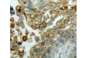 IHC-P analysis of Lung tissue, with DAB staining. (Cyclin D3 抗体  (AA 1-292))