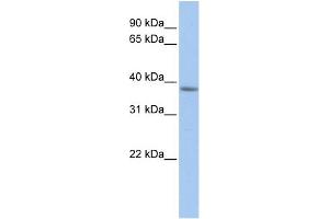 WB Suggested Anti-C2orf33 Antibody Titration:  0. (MFF 抗体  (C-Term))
