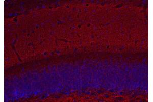 Indirect immunostaining of PFA fixed mouse hippocampus section (dilution 1 : 500; red). (Complexin 1, 2 (AA 122-134) 抗体)