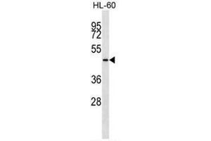 KRT28 Antibody (C-term) western blot analysis in HL-60 cell line lysates (35µg/lane). (Cytokeratin 28 抗体  (C-Term))