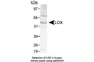 Image no. 2 for anti-Lysyl Oxidase (LOX) (AA 200-300), (Internal Region) antibody (ABIN363533) (LOX 抗体  (Internal Region))