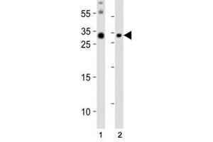 Western blot analysis of lysate from (1) mouse brain and (2) mouse skeletal muscle tissue lysate using Olig3 antibody at 1:1000. (OLIG3 抗体  (N-Term))