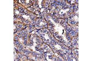 IHC analysis of NEAS/SPTAN1 using anti-NEAS/SPTAN1 antibody (ABIN7600436).