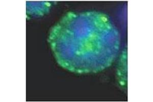 Immunofluorescence (IF) image for anti-Microtubule-Associated Protein 1 Light Chain 3 beta (MAP1LC3B) (AA 1-30), (N-Term) antibody (ABIN5555711)
