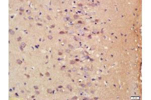 Immunohistochemistry (Paraffin-embedded Sections) (IHC (p)) image for anti-S100 Calcium Binding Protein B (S100B) (AA 31-92) antibody (ABIN676703)