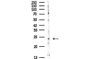 Western blot analysis of lysates from HepG2 cells(heat-shock, 45 min treatment), using RA Antibody at 1/1000 dilution.