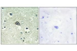 Immunohistochemical analysis of paraffin-embedded human brain tissue using NMDAR1 (Phospho-Ser890) antibody (left)or the same antibody preincubated with blocking peptide (right). (GRIN1/NMDAR1 抗体  (pSer890))