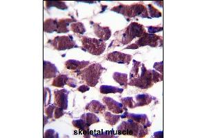 LRIG2 Antibody (C-term) (ABIN657742 and ABIN2846726) immunohistochemistry analysis in formalin fixed and paraffin embedded human skeletal muscle followed by peroxidase conjugation of the secondary antibody and DAB staining. (LRIG2 抗体  (C-Term))