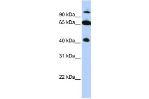 Western Blotting (WB) image for anti-Tripartite Motif Containing 9 (TRIM9) antibody (ABIN2458078) (TRIM9 抗体)