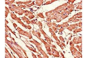 Immunohistochemistry (IHC) image for anti-Mitofusin 2 (MFN2) (AA 61-158) antibody (ABIN7159968)