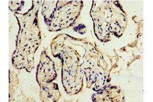 Immunohistochemistry of paraffin-embedded human placenta tissue using ABIN7150057 at dilution of 1:100 (ADAM33 抗体  (AA 140-420))