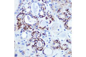Immunohistochemistry (IHC) image for anti-Hexokinase 1 (HK1) antibody (ABIN7267638)