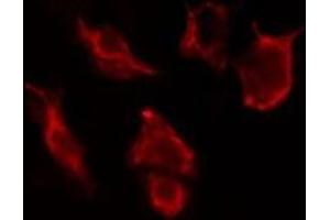 ABIN6277108 staining HuvEc cells by IF/ICC. (CD90 抗体  (Internal Region))