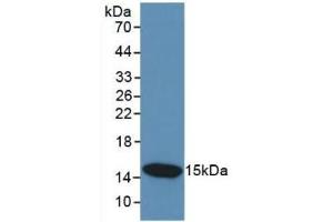 Detection of Recombinant CST3, Human using Monoclonal Antibody to Cystatin C (Cys-C) (CST3 抗体  (AA 27-146))