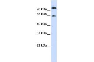 WB Suggested Anti-RUNX1T1 Antibody Titration: 0. (RUNX1T1 抗体  (Middle Region))