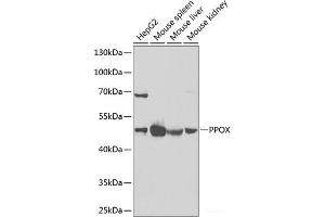 Western blot analysis of extracts of various cell lines using PPOX Polyclonal Antibody at dilution of 1:1000. (PPOX 抗体)