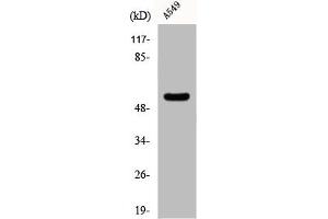 Western Blot analysis of Jurkat cells using CHST2 Polyclonal Antibody (CHST2 抗体  (N-Term))