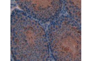 Immunohistochemistry (IHC) image for anti-Cytochrome P450, Family 11, Subfamily A, Polypeptide 1 (CYP11A1) (AA 329-526) antibody (ABIN5013425)