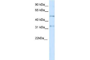 WB Suggested Anti-KCNAB2 Antibody Titration:  0. (KCNAB2 抗体  (Middle Region))