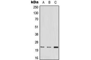 Western blot analysis of MED22 expression in A549 (A), mouse heart (B), rat liver (C) whole cell lysates. (MED22 抗体  (N-Term))