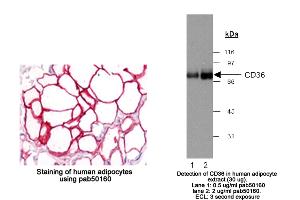 Image no. 3 for anti-CD36 (CD36) (AA 100-200) antibody (ABIN363469) (CD36 抗体  (AA 100-200))