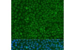 Immunofluorescence analysis of U2OS cells using YWHAZ Polyclonal Antibody at dilution of 1:100. (14-3-3 zeta 抗体)
