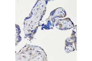 Immunohistochemistry of paraffin-embedded human placenta using ErbB4/HER4 Rabbit pAb (ABIN6131263, ABIN6140257, ABIN6140260 and ABIN6221732) at dilution of 1:100 (40x lens). (ERBB4 抗体  (AA 26-160))