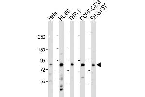 All lanes : Anti-LRCH4 Antibody (Center) at 1:2000 dilution Lane 1: Hela whole cell lysate Lane 2: HL-60 whole cell lysate Lane 3: THP-1 whole cell lysate Lane 4: CCRF-CEM whole cell lysate Lane 5: SH-SY5Y whole cell lysate Lysates/proteins at 20 μg per lane. (LRCH4 抗体  (AA 305-348))