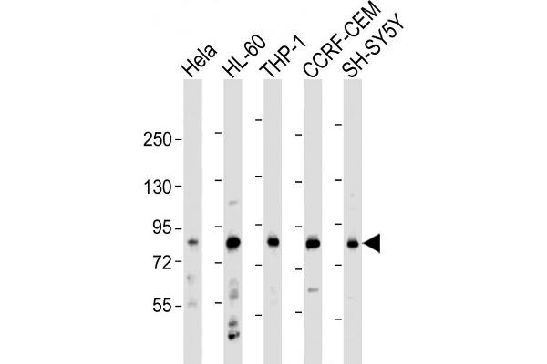LRCH4 anticorps  (AA 305-348)