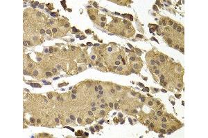 Immunohistochemistry of paraffin-embedded Human stomach using SETD5 Polyclonal Antibody at dilution of 1:100 (40x lens). (SETD5 抗体)